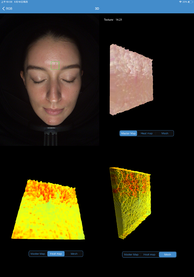 3d hudanalysator teksturanalyse