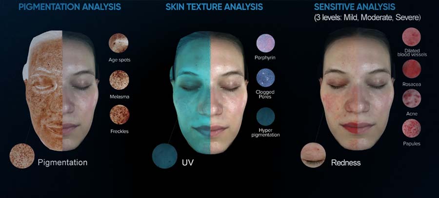 Dekodiranje mašinskog učenja unutar inteligencije budućih vodećih proizvoda za analizu kože iz Kine2