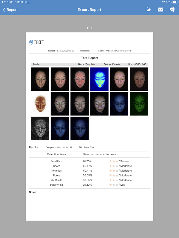 Meicet skin analyzer MC88 jinsi ya kusaidia ripoti yako ya jaribio la uuzaji 1