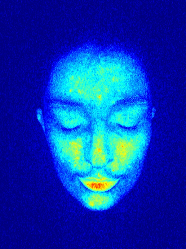 Meicet skin analzyer akne scanner heatmap