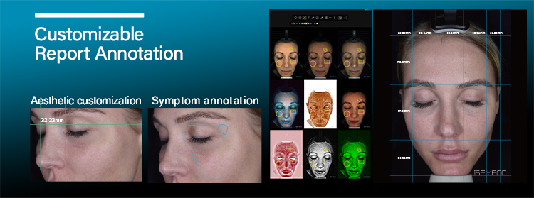 S7 Skin Analyzer (10)