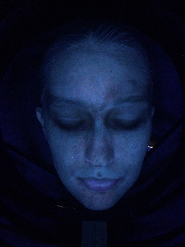 analizzatore di pelle con luce uv per acne