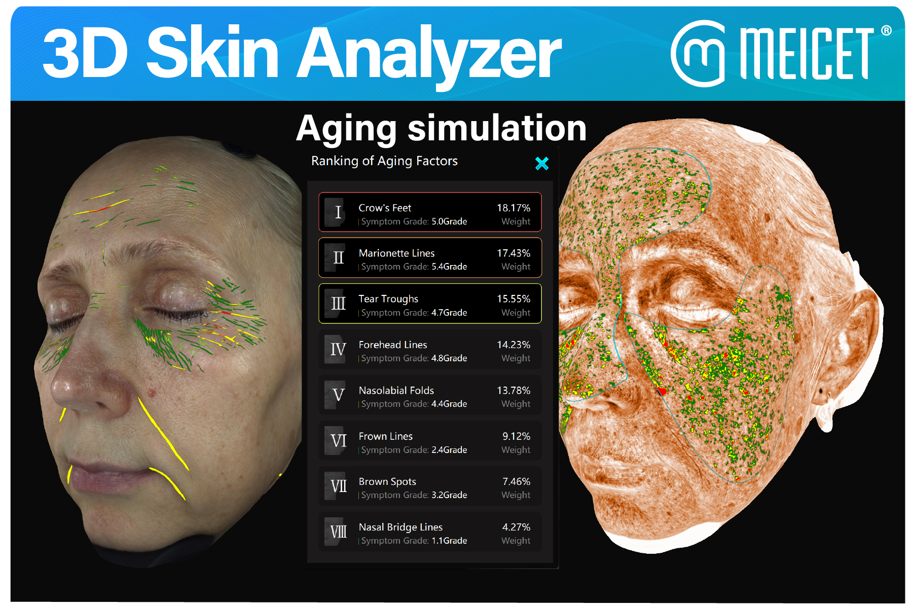 3D Skin Analyzer 3(1)