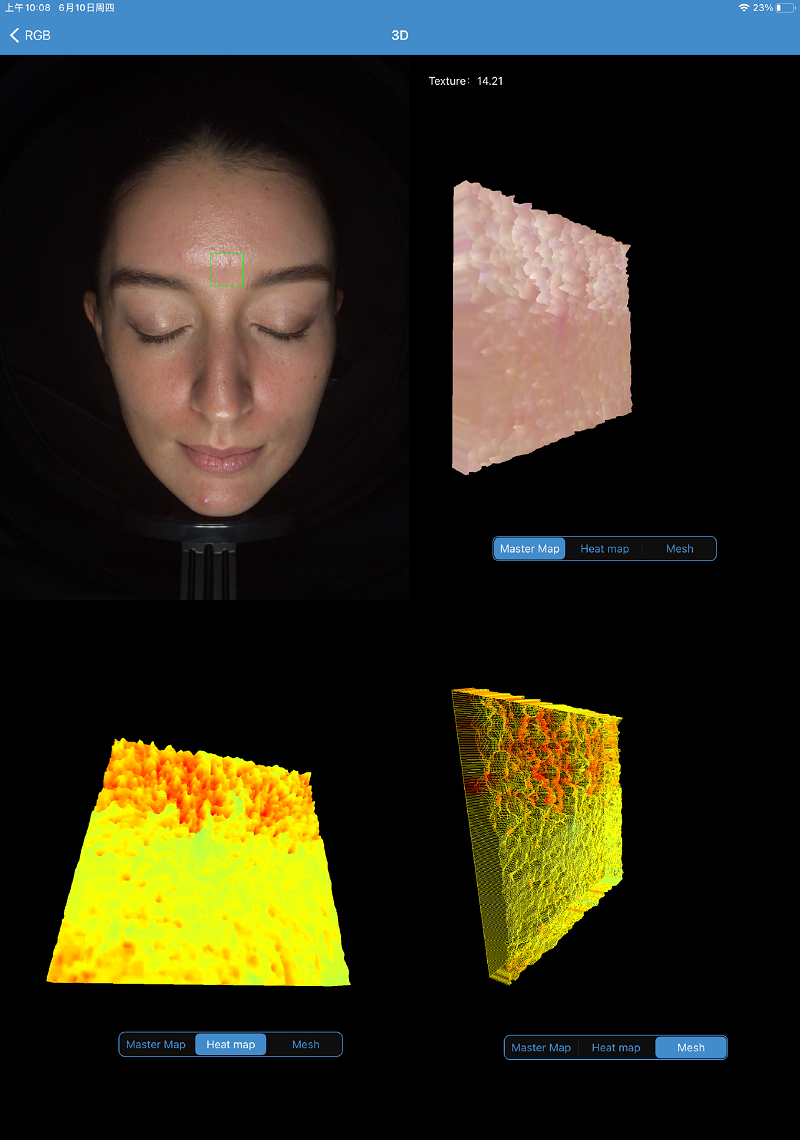 3d skin analyzer texture analysis