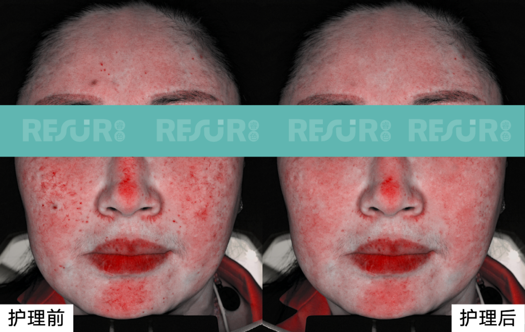 Skin Aging ——Skincare