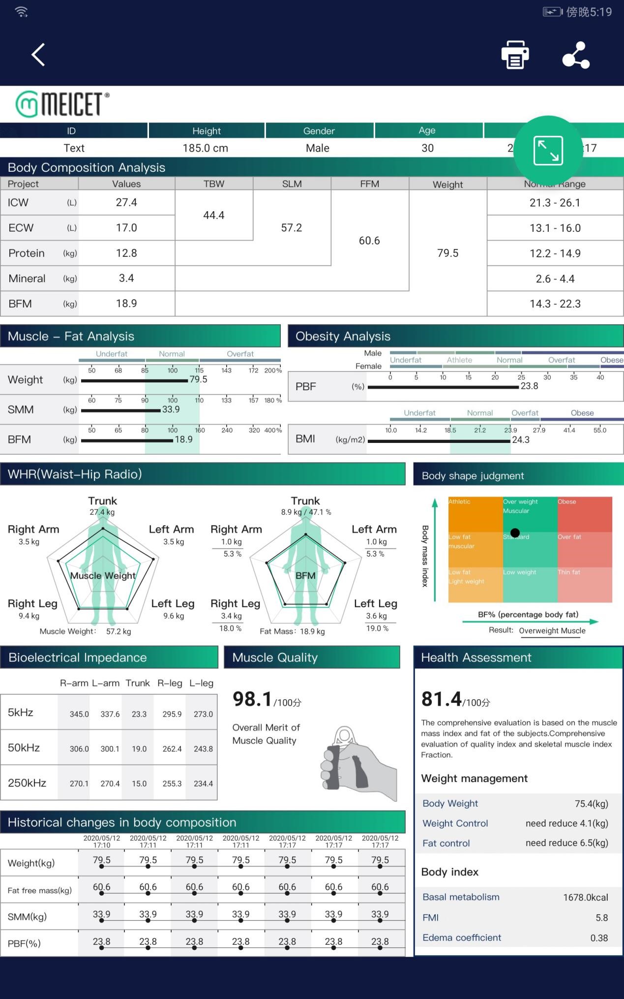 Meicet  China China Wholesale Body Composition Analysis Accuracy  Manufacturers – 3D Scale And Biometric Body Fat Composition Analyzer Scale  Bia Bioelectrical Impedance Bioelectrical Impedance Analysis Machine –  Meicet Manufacture and Factory