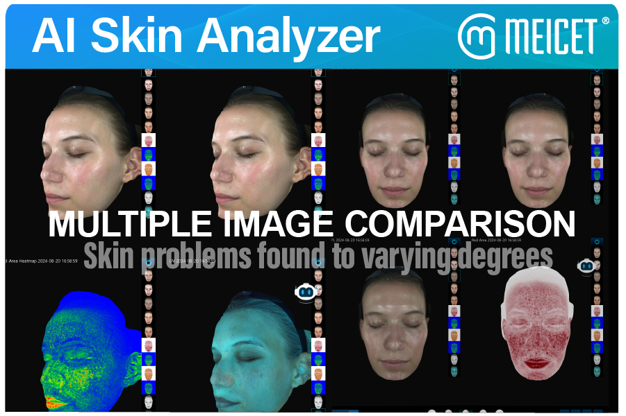 AI Skin Analyzer 5