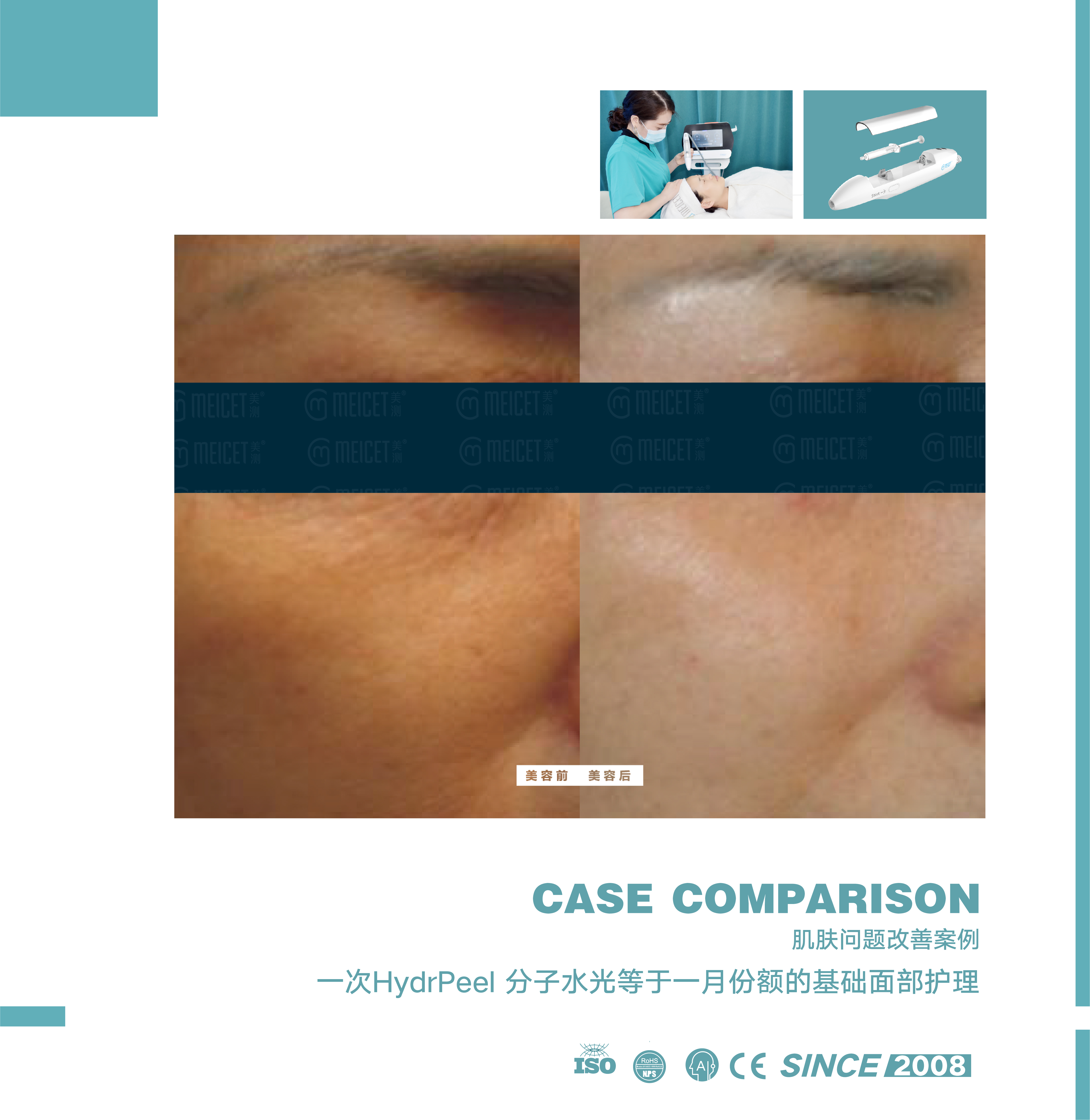 Epidermal structural and biochemical changes in skin aging
