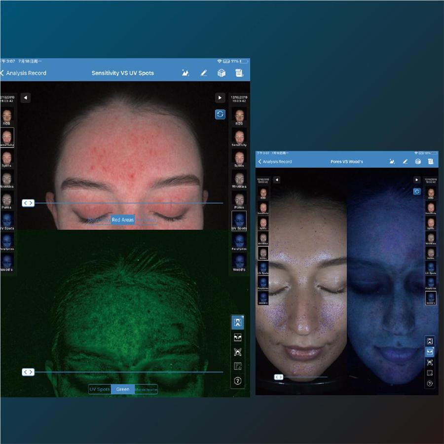 Face Analysis Machine-3