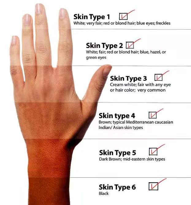 Fitzpatrick Skin Type