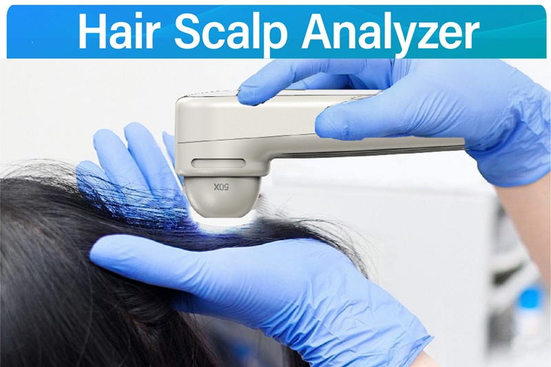 Hair Scalp Analyzer 1