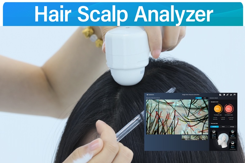 Hair Scalp Analyzer 6