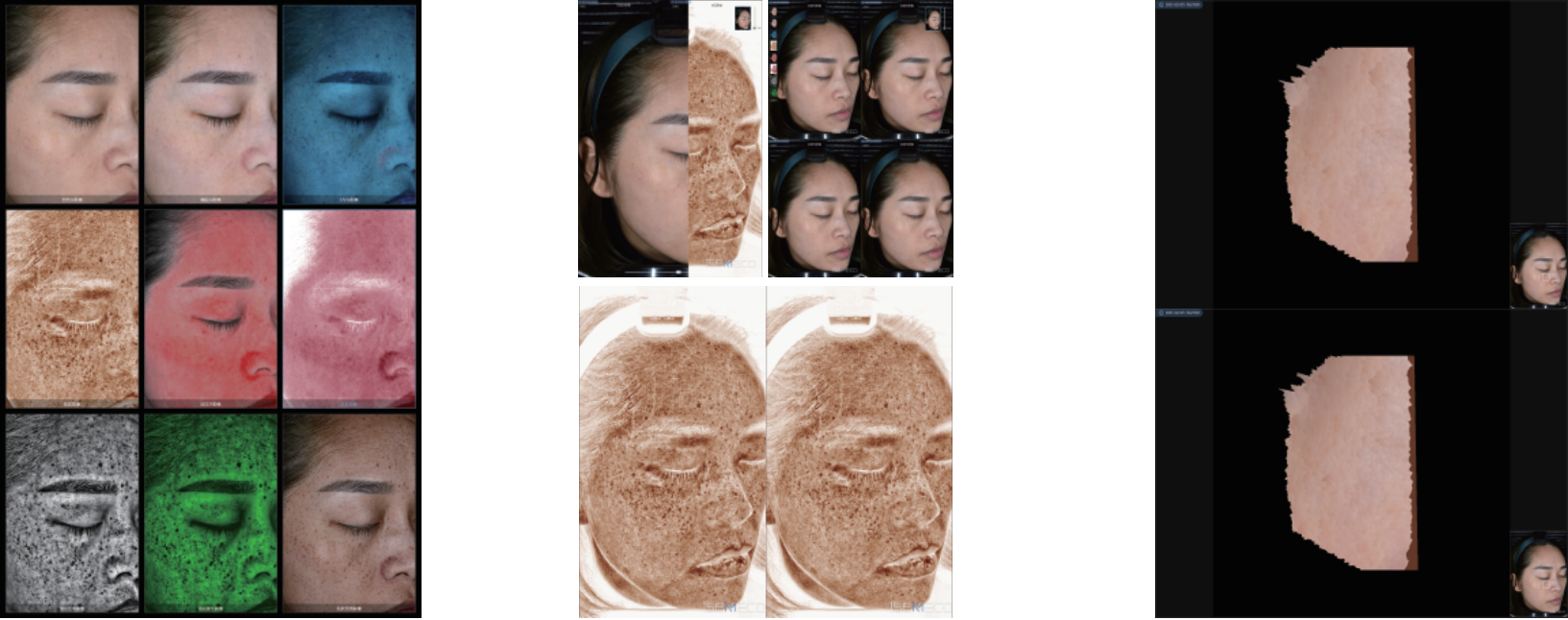 ISEMECO pofessional high-end best skin analyzer machine comparison