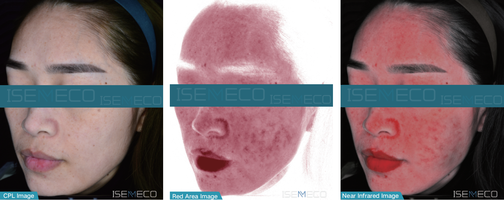 ISEMECO pofessional high-end best skin analyzer machine cpl red near infrared image