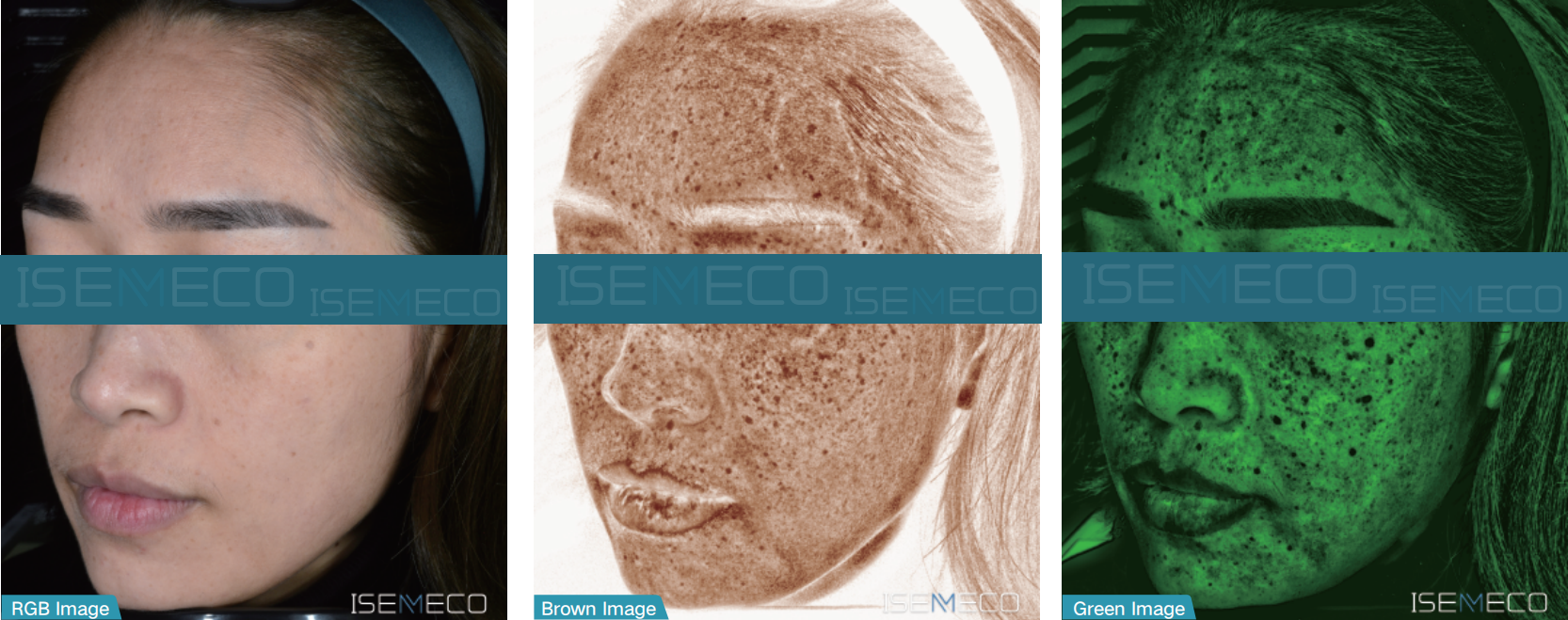 ISEMECO pofessional high-end best skin analyzer machine rgb brown green image