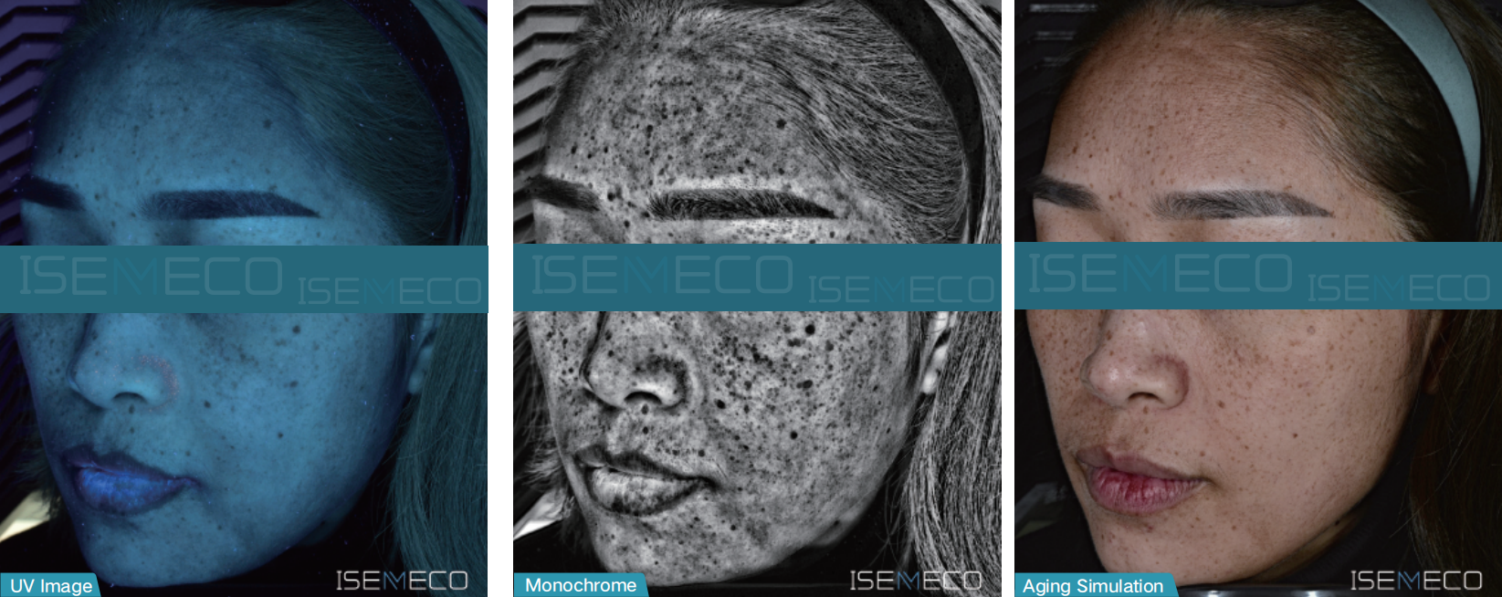 ISEMECO pofessional high-end best skin analyzer machine uv monochrome aging image