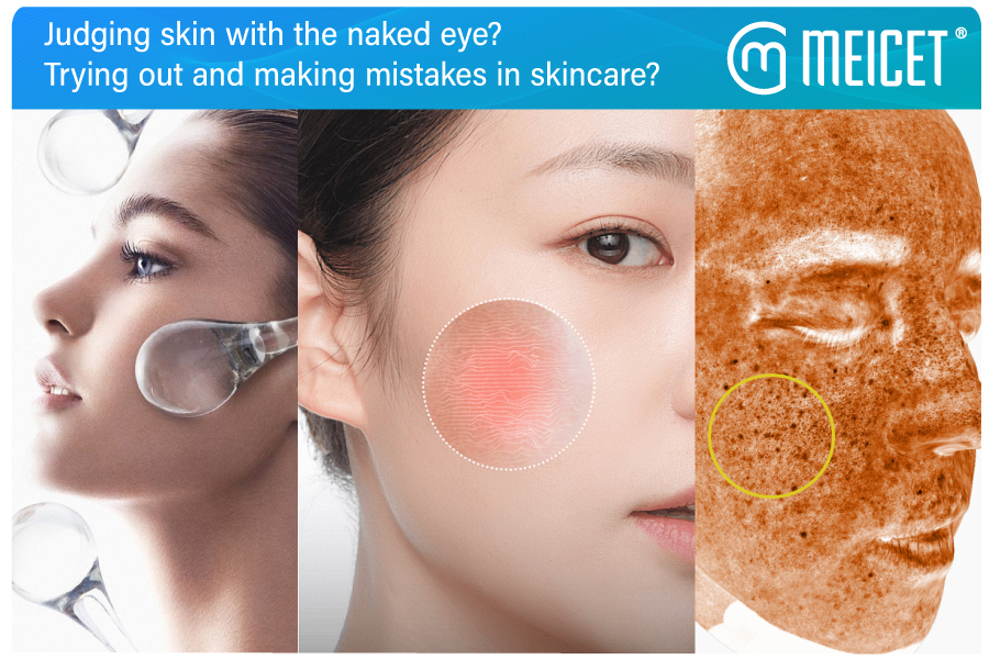 Judging-skin-with-the-naked-eye---Trying-out-and-making-mistakes-in-skincare