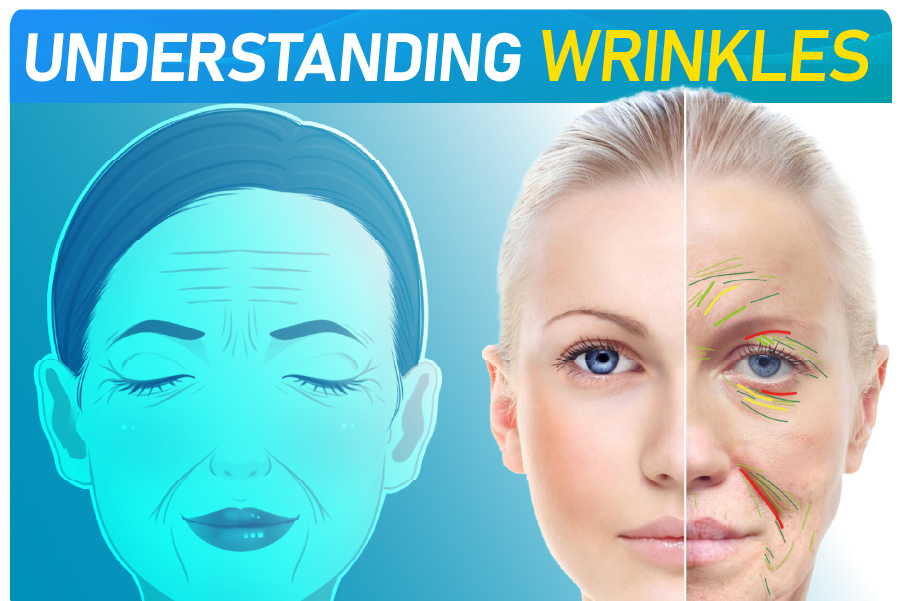 Kunzwisisa Wrinkles