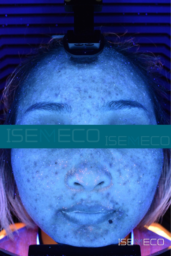 The Composition and Influencing Factors of Skin Microbes