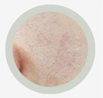 Causes of coarse pores