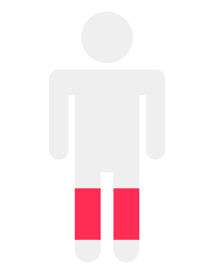 O X Type Legs