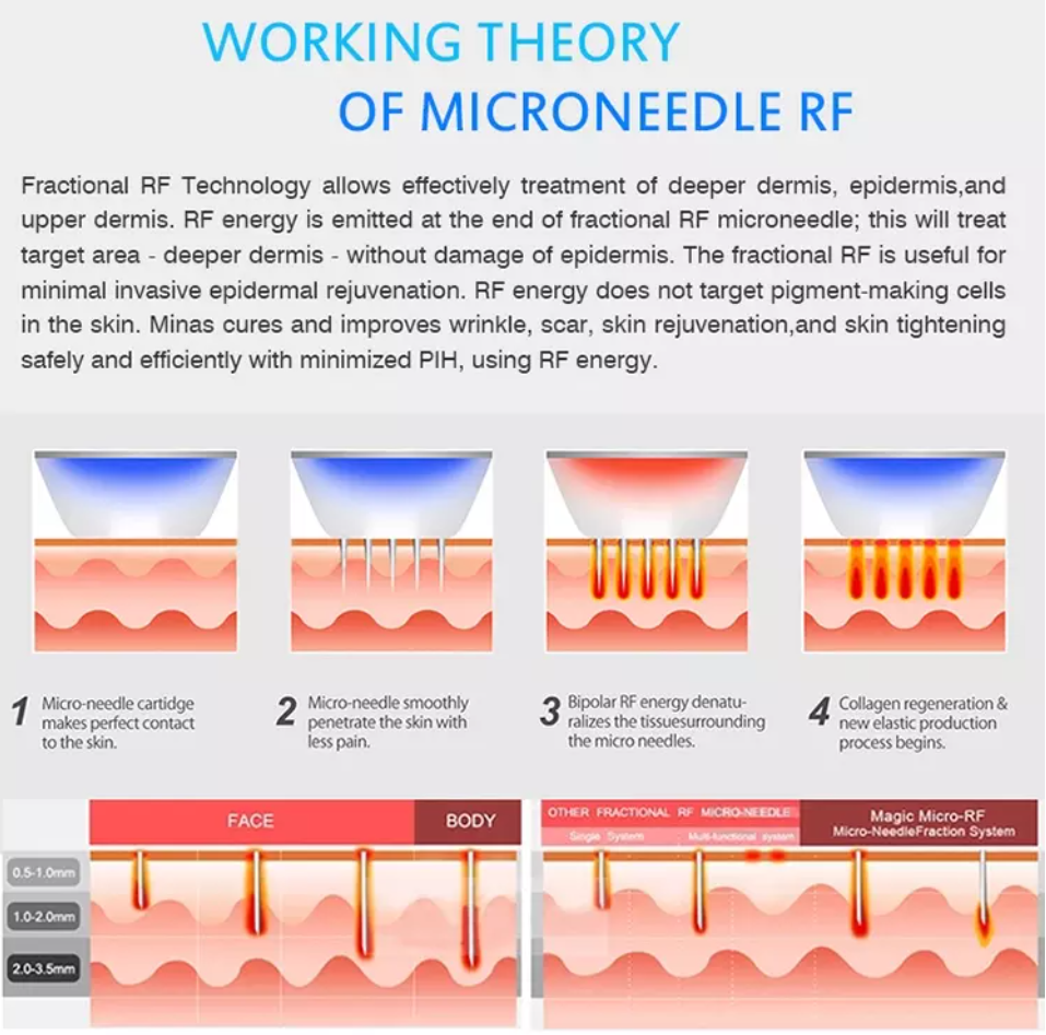 RF Machine