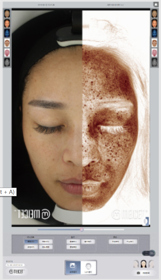 Resur Skin Analyzer Mirror Comparison