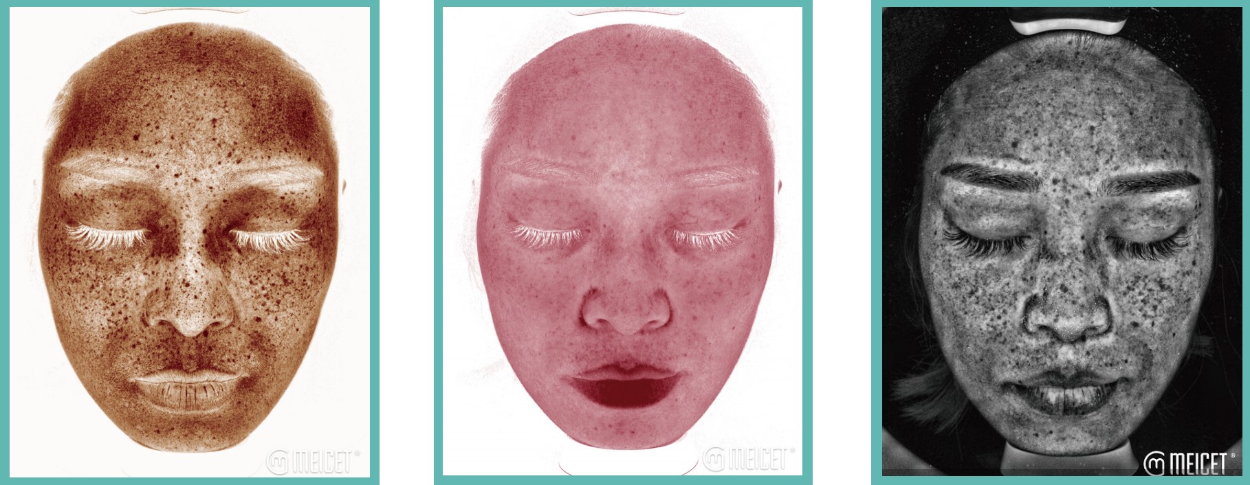 Resur professional skin analyzer 3 analysis images