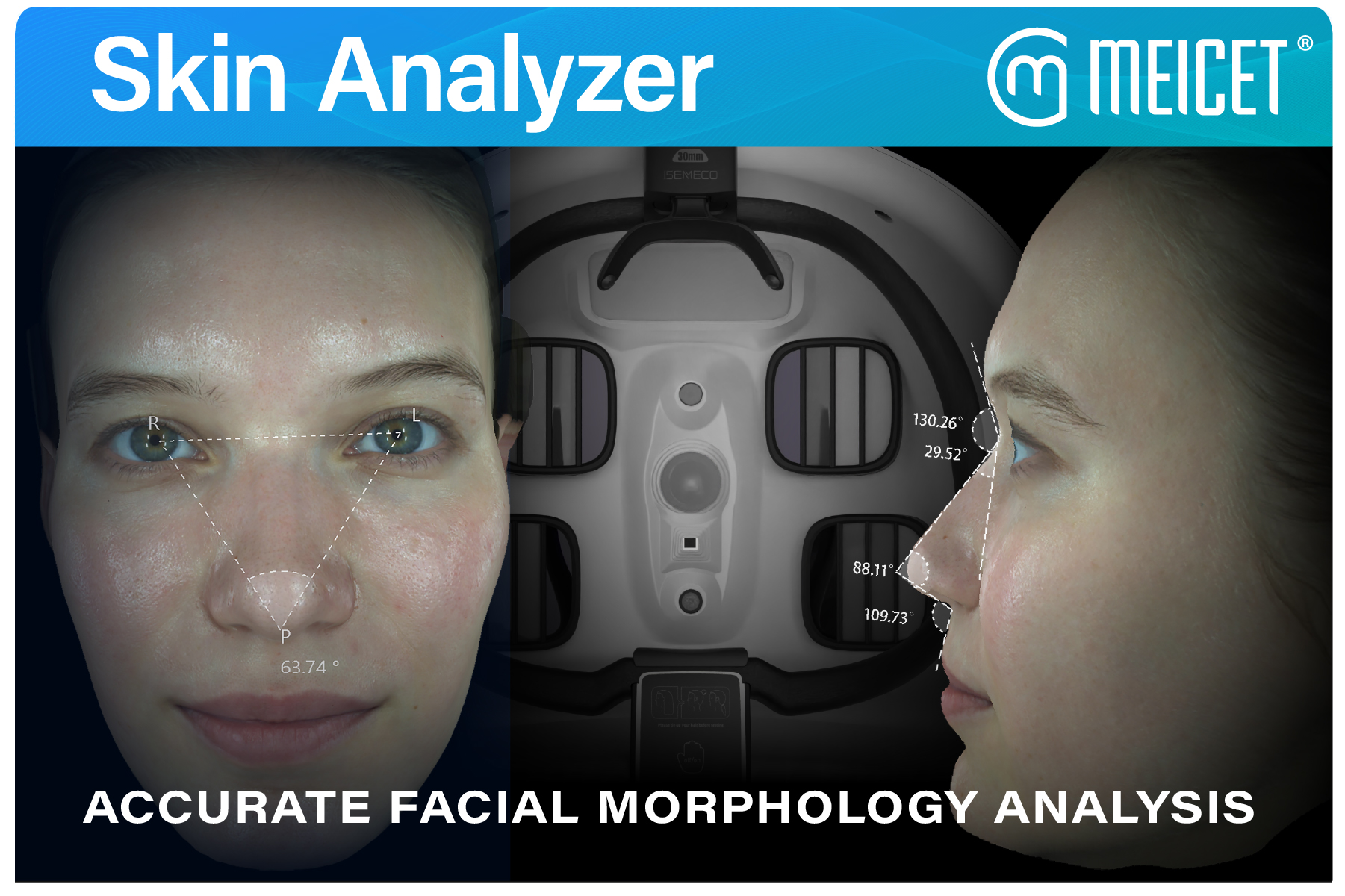 Skin Analyzer 5
