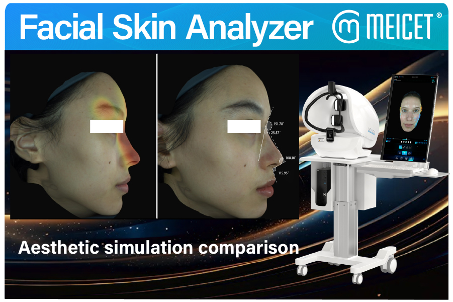 facial skin analyzer 2