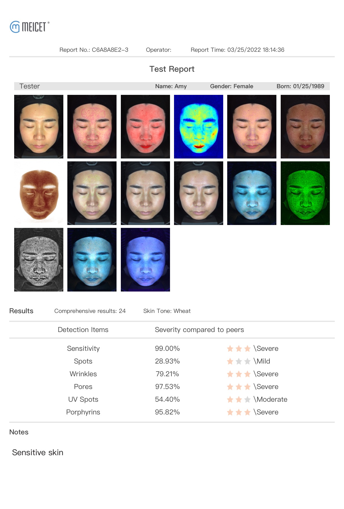 meicet skin analyzer MC88 report page 1