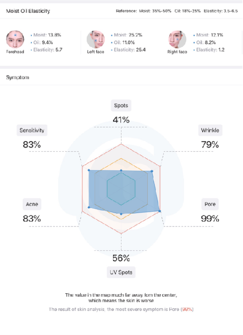 meicet skin analyzer adding reports with moisture oil elasticity