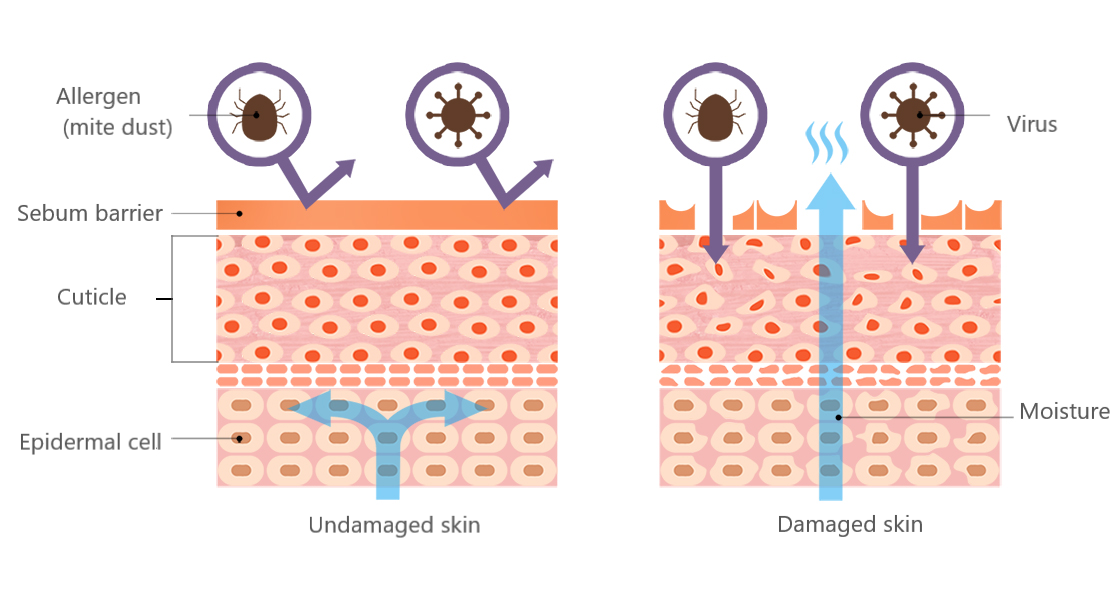 Skin problems: sensitive skin