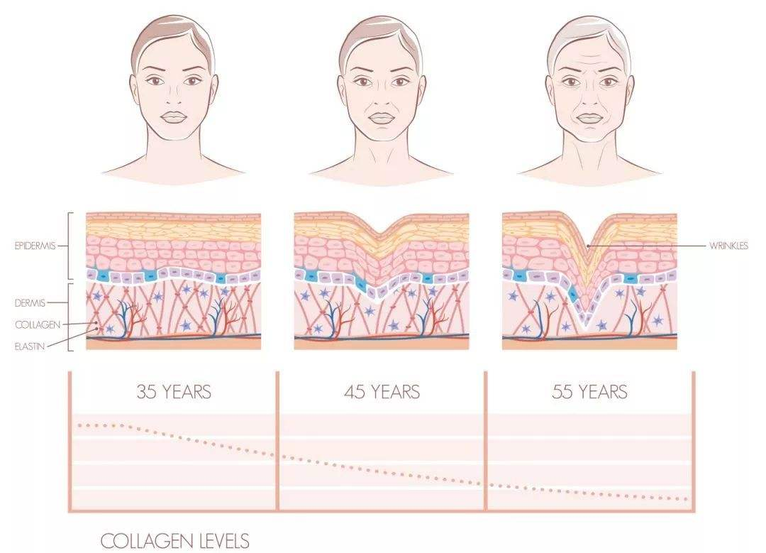 Analisis panyebab: Panyebab penuaan kulit——Kenapa kulit dadi longgar?