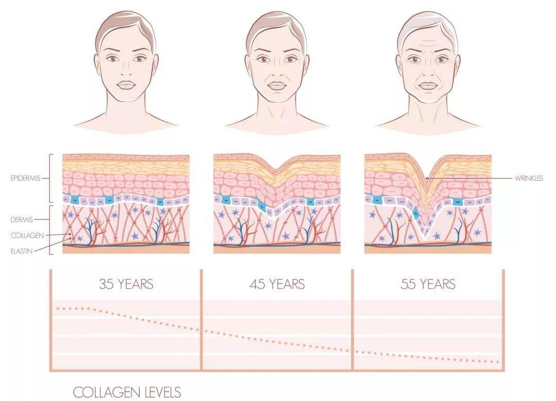 Cause analysis: Causes of skin aging——Why is the skin loose?