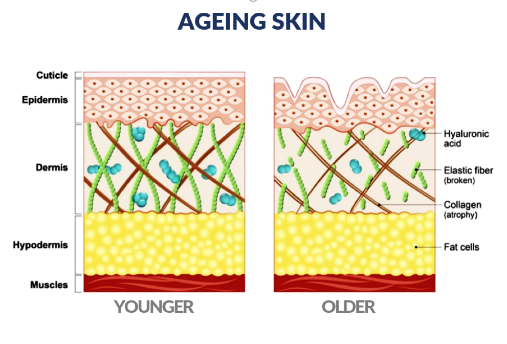 News - Where does facial aging begin?Professional Facial Aging Grading ...