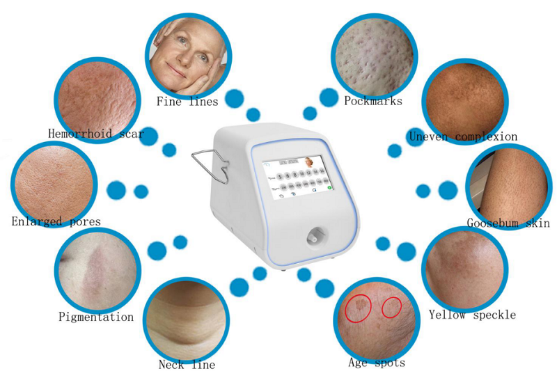 tixel treatment cost