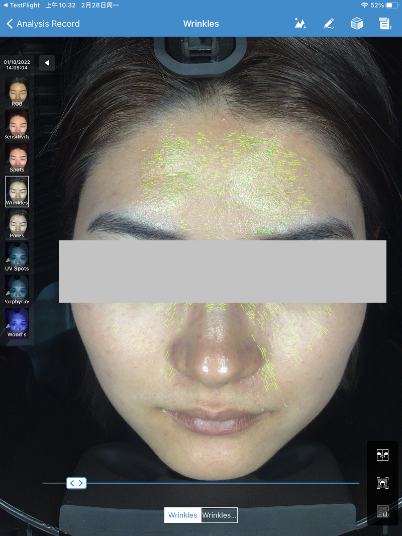 Meicet Skin Analyzerの偏光イメージングによるシワ検出