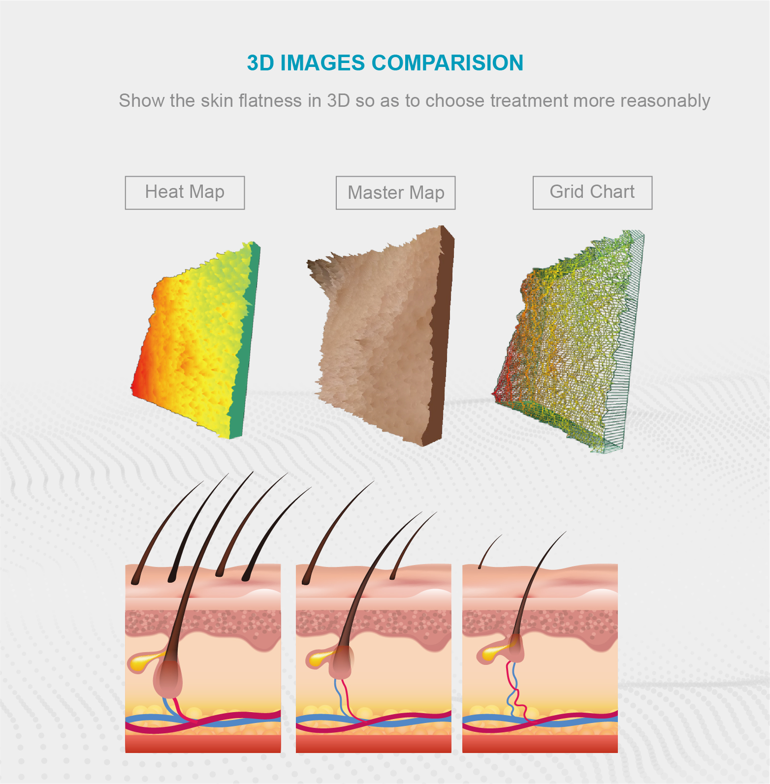 Polarization Imaging for Skin Analyzer