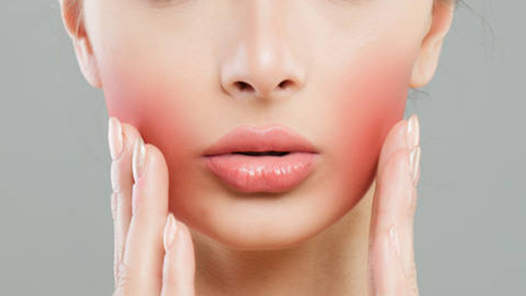 Skin problems: Dry and Peeling