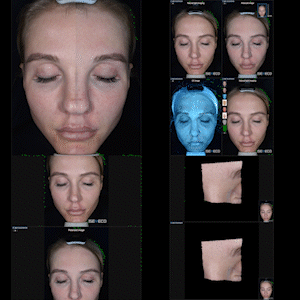 Multi-Image Comparison