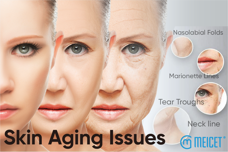 Aging analysis: Skin aging produces 3 stages