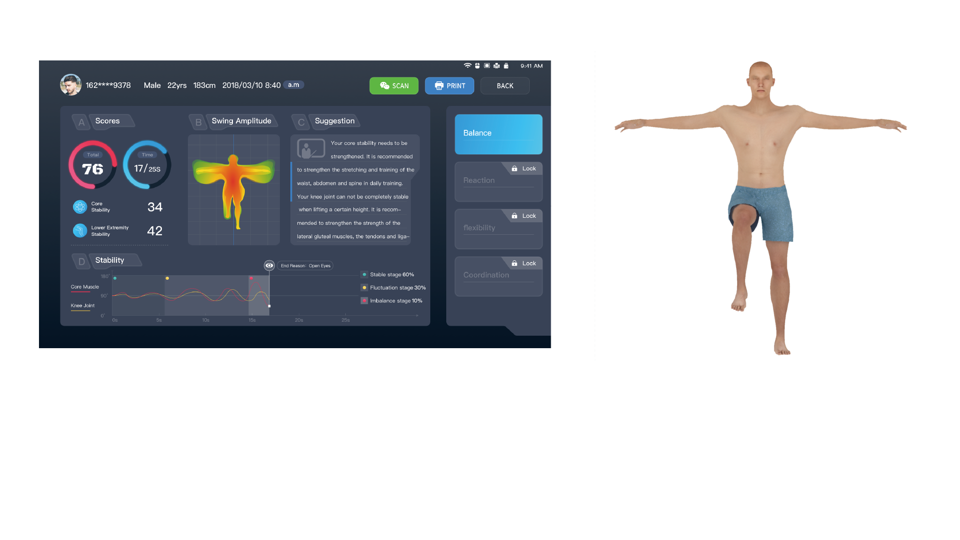 Visualización de resultados equilibrados