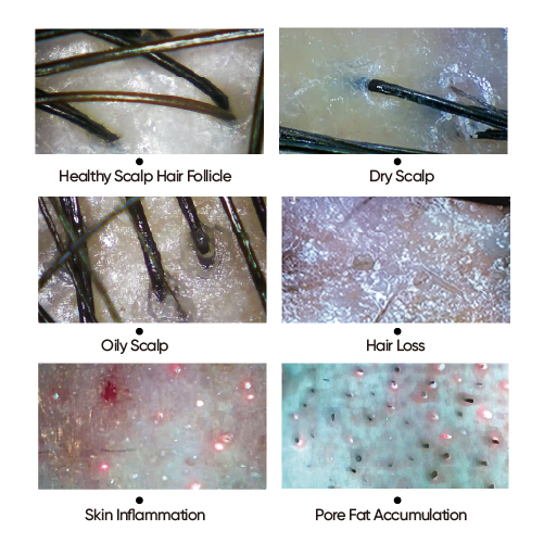 Schematic Diagram Of Scalp Hair Follicle Skin.