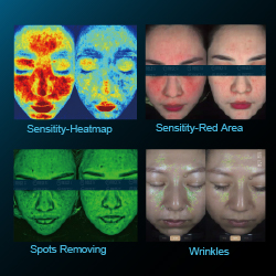 Before-After Comparison